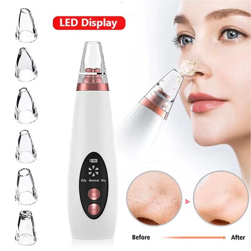 Vacuum Pore Cleaner
